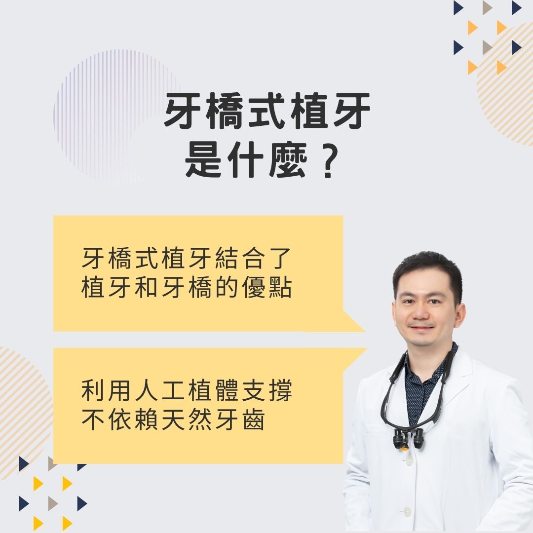 說明什麼是牙橋式植牙
