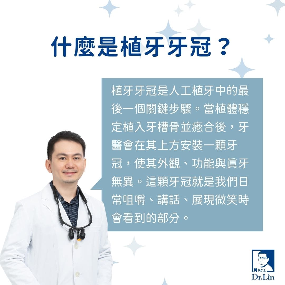 植牙牙冠有哪些材質?植牙牙冠5材質3種挑選方法讓你一次上手 1 什麼是植牙牙冠