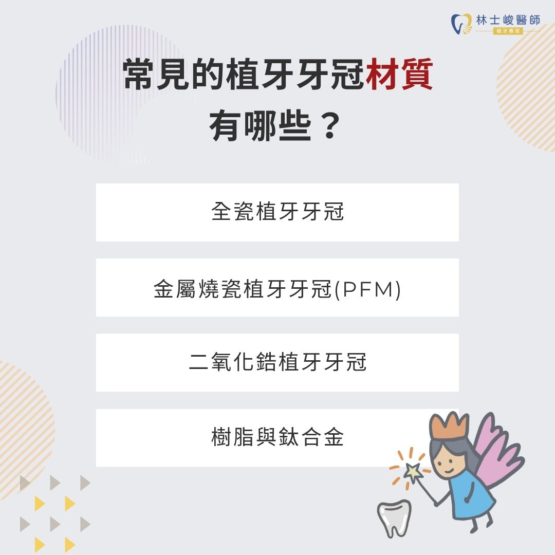 植牙牙冠有哪些材質?植牙牙冠5材質3種挑選方法讓你一次上手 2 常見的植牙牙冠材質有哪些