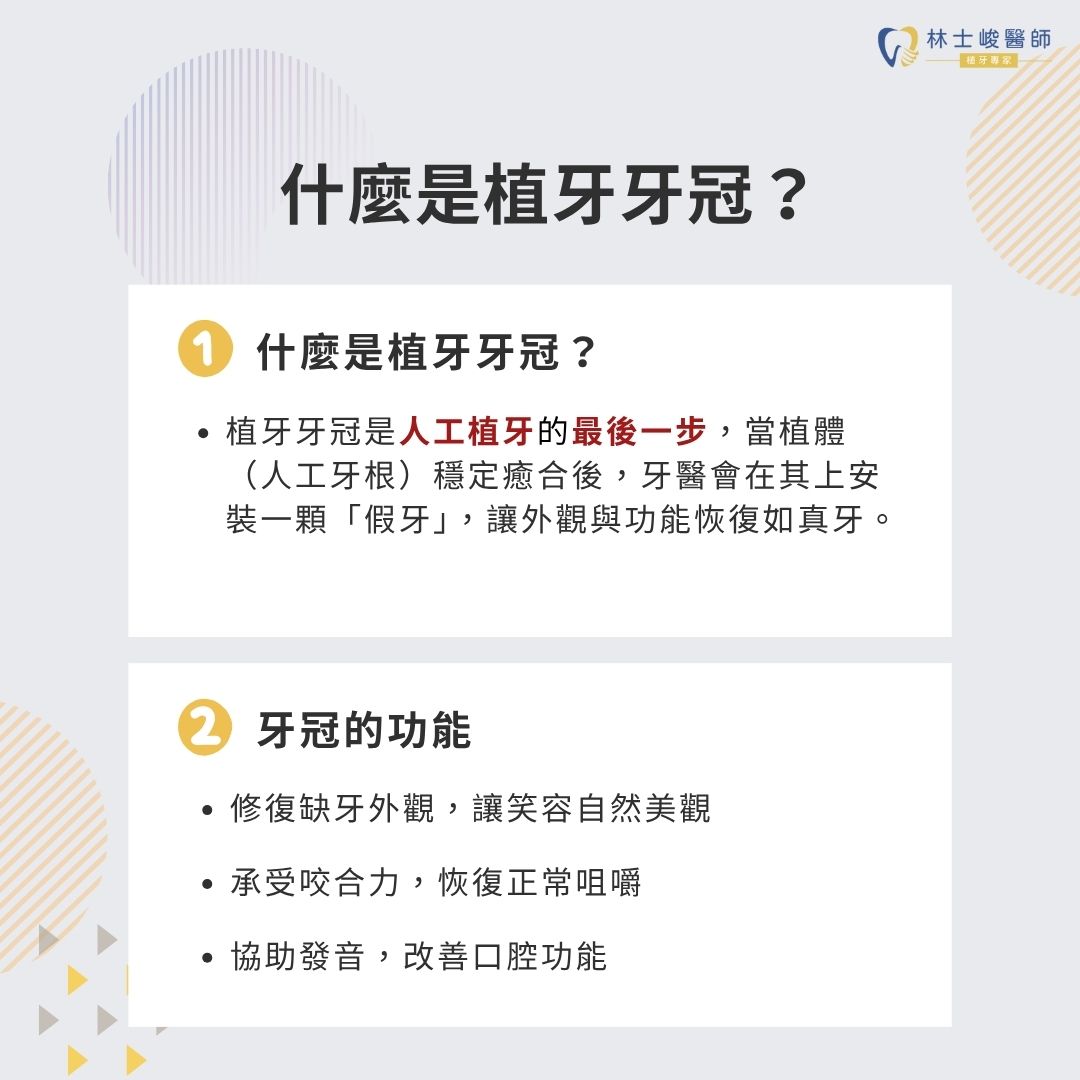 植牙牙冠有哪些材質?植牙牙冠5材質3種挑選方法讓你一次上手 1 什麼是植牙牙冠