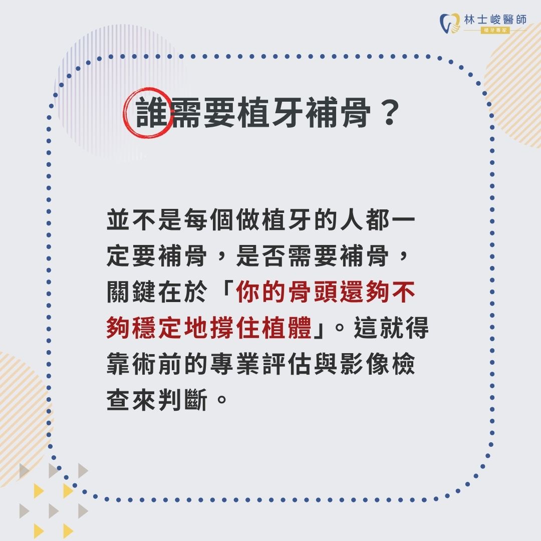 植牙補骨費用怎麼算?搞懂項目與價格差異,避免植牙補骨術亂收費 2 誰需要植牙補骨