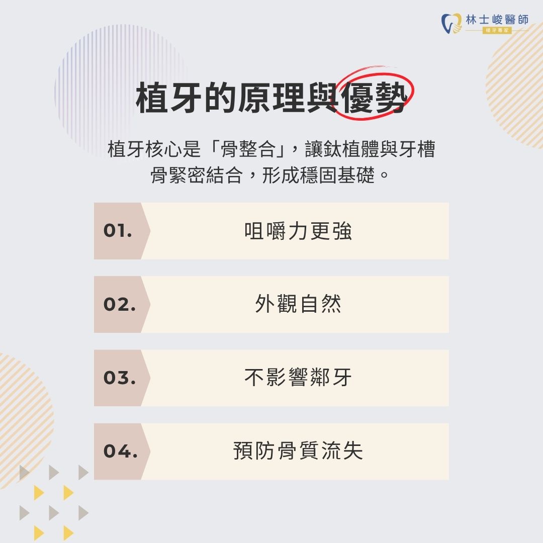 植牙療程步驟大公開!詳解植牙程序,讓你安心看牙 1 植牙的原理與優勢
