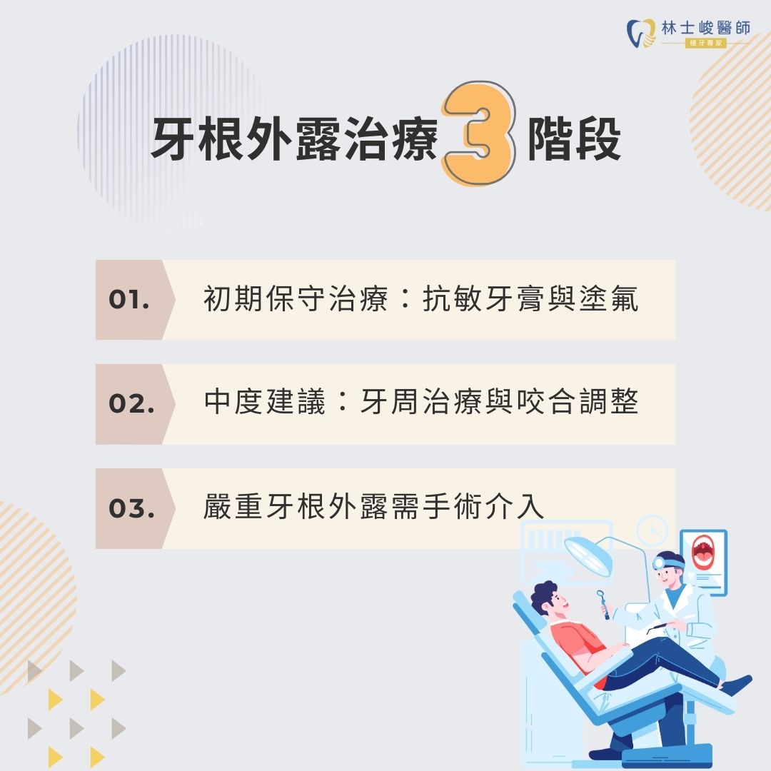 牙齒變長其實是牙根外露?破解常見迷思與應對方法 4 牙根外露治療3階段