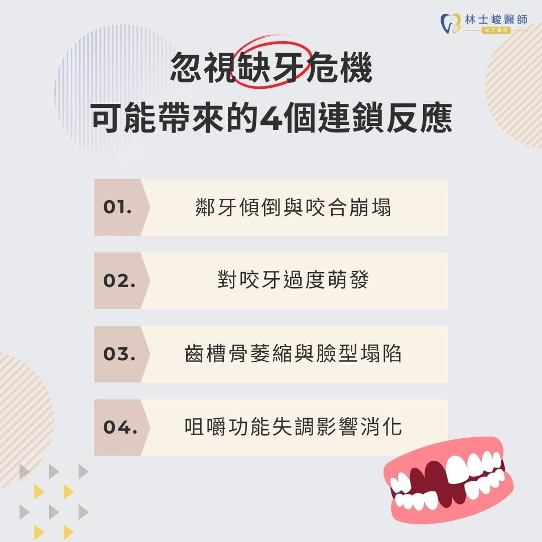 忽視缺牙危機可能帶來的4個連鎖反應