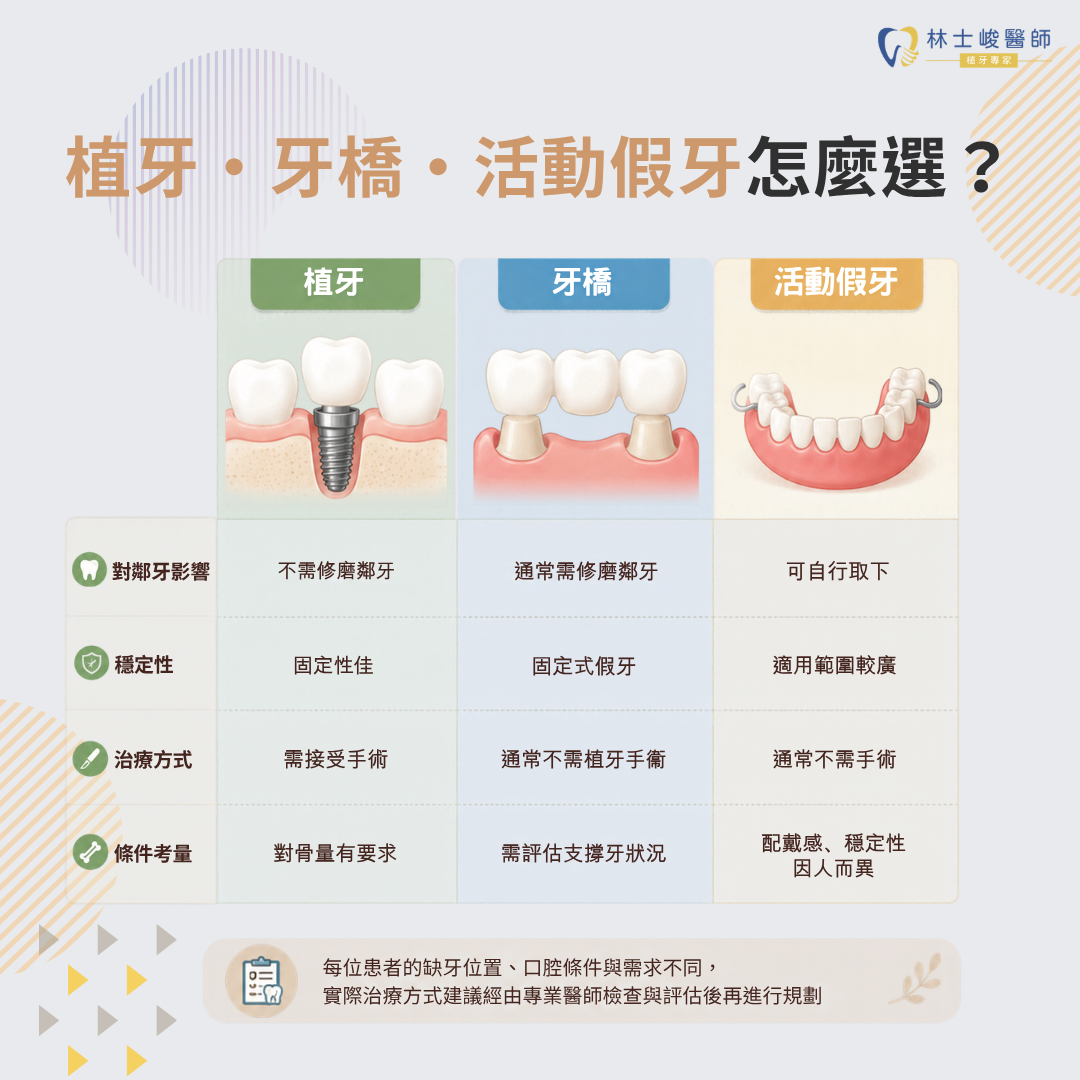 植牙牙橋活動假牙比較