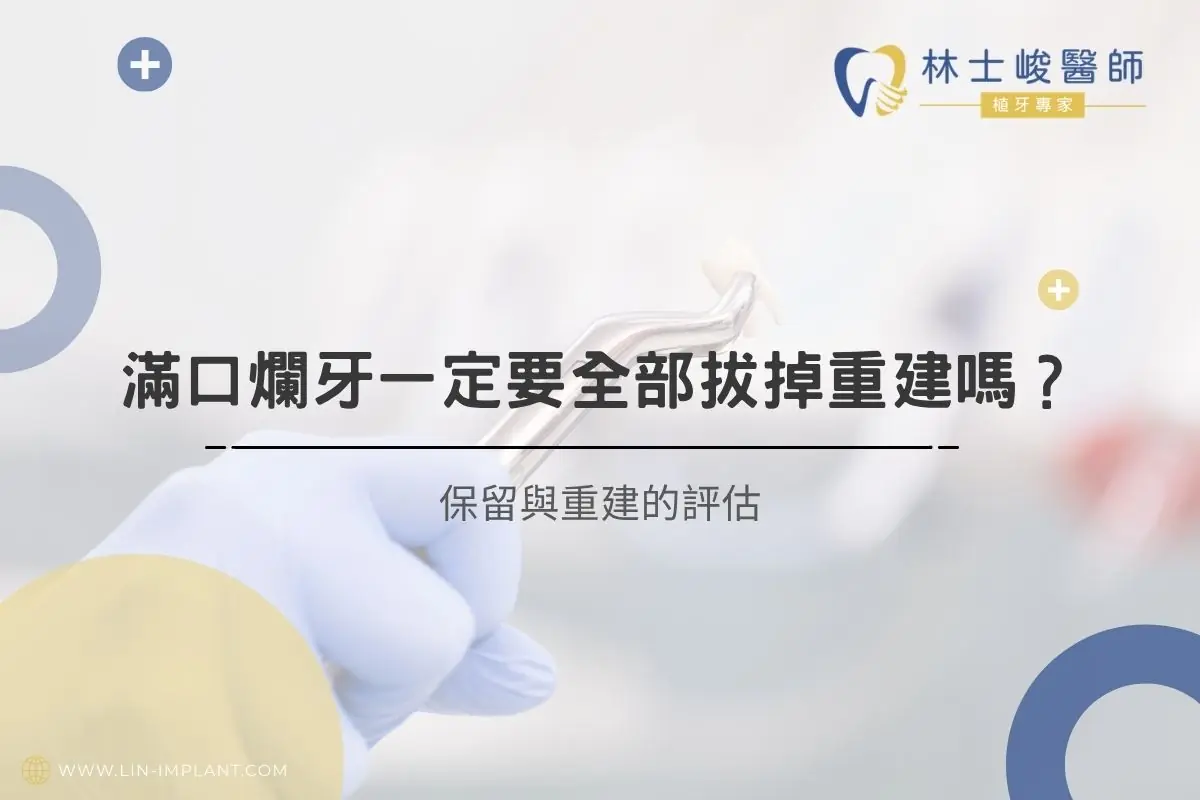 滿口爛牙一定要全部拔掉重建嗎？保留與重建的評估