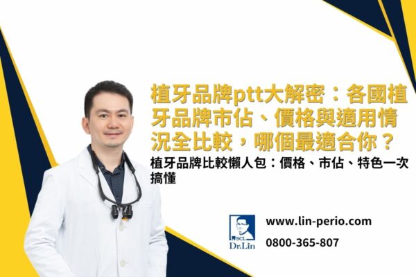 植牙品牌ptt大解密：各國植牙品牌市佔、價格與適用情況全比較，哪個最適合你？