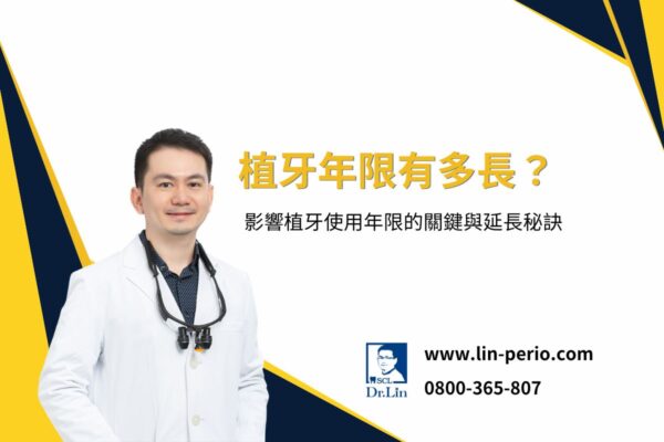 植牙年限有多長？影響植牙使用年限的關鍵與延長秘訣