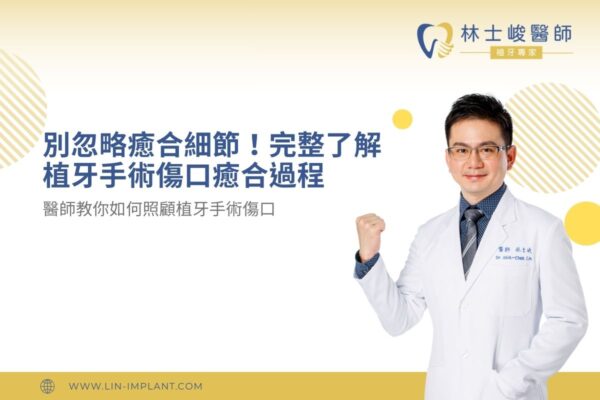 dental-implant-wound 別忽略癒合細節!完整了解植牙手術傷口癒合過程