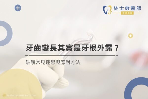 牙齒變長其實是牙根外露？破解常見迷思與應對方法