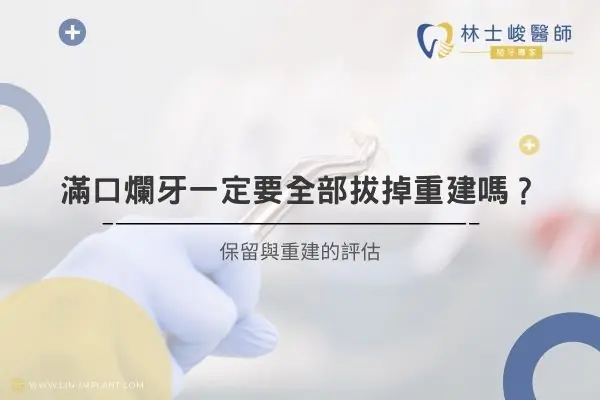 滿口爛牙一定要全部拔掉重建嗎？保留與重建的評估