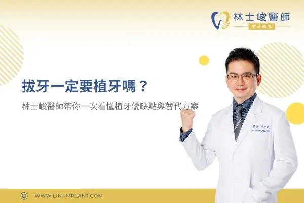 拔牙一定要植牙嗎？林士峻醫師帶你一次看懂植牙優缺點與替代方案