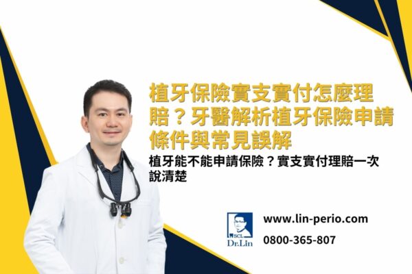 reimbursement-based-insurance 植牙保險實支實付怎麼理賠?牙醫解析植牙保險申請條件與常見誤解
