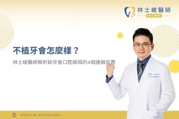 不植牙會怎麼樣？林士峻醫師解析缺牙後口腔崩塌的 4 個連鎖反應