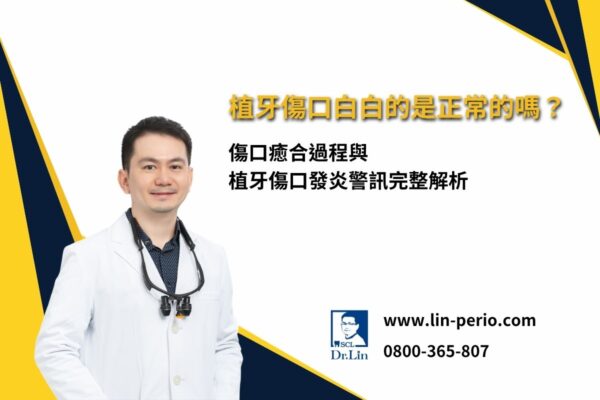植牙傷口白白的是正常的嗎？傷口癒合過程與植牙傷口發炎警訊完整解析