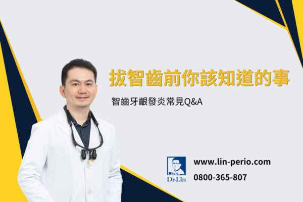 拔智齒前你該知道的事：智齒牙齦發炎常見Q&A